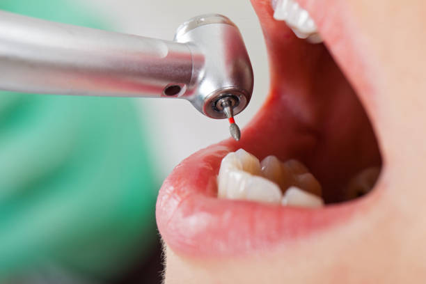 Best Emergency Dental Services for Seniors in Ridgefield, WA
